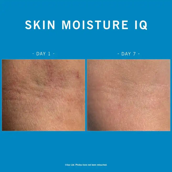 Advanced Nutrition Programme Skin Moisture IQ 28x5 caps